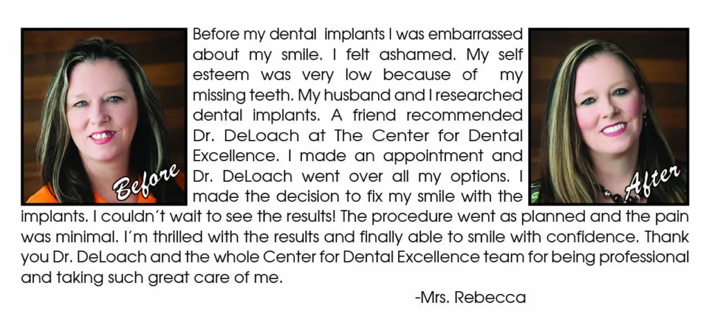 Mrs Rebecca review of implant dentistry at Center For Dental Excellence with before & after photos